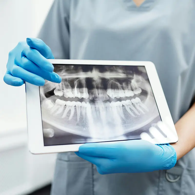 https://sandiegotopdentist.com/wp-content/uploads/2025/03/Dental-Surgery-Mission-Family-Dental.webp